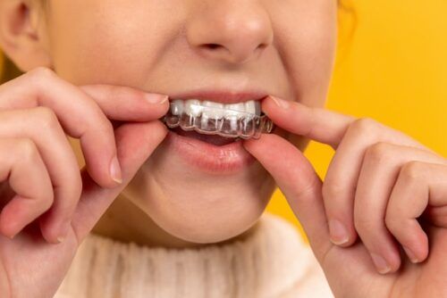 Ortodonta w Kielcach: Na czym polega leczenie wad zgryzu?